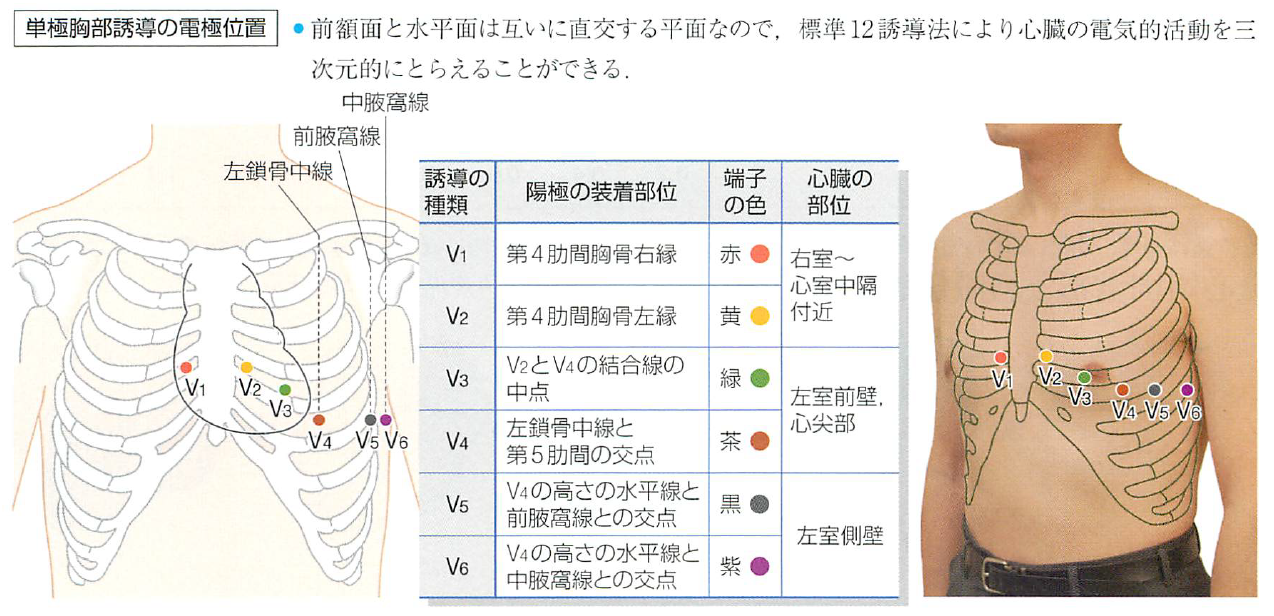心電図電極手入れ, 心電図 電極の付け間違い – BSKRS