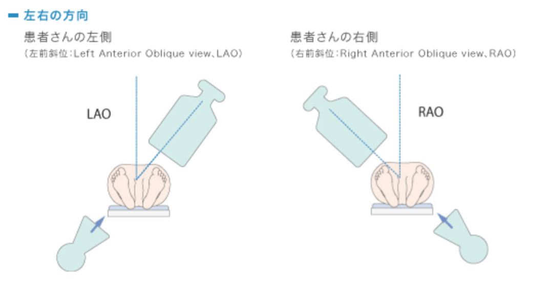 Lpo Rpo Lao Roa Ap Pa Rao Lpo 正面 側面 斜位 照射方向の記載とその考え方 – IVDWG