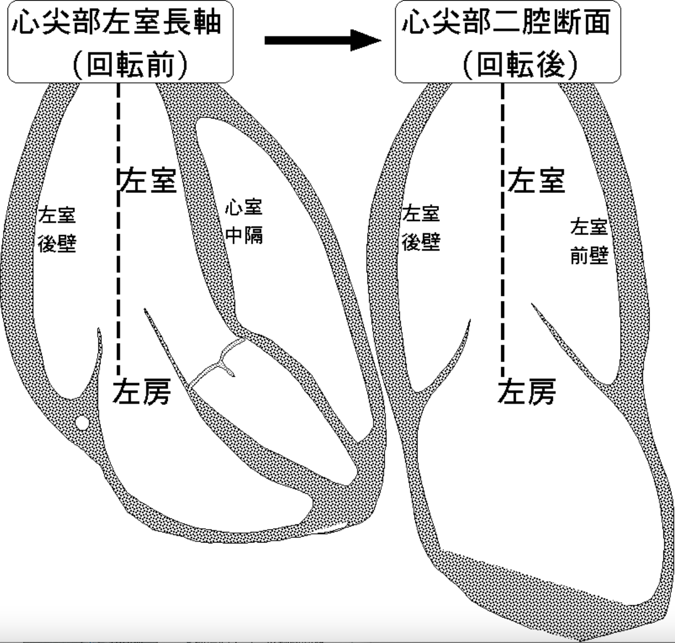 【循環器総論-12】 心エコー | 心臓血管外科 ️美容外科