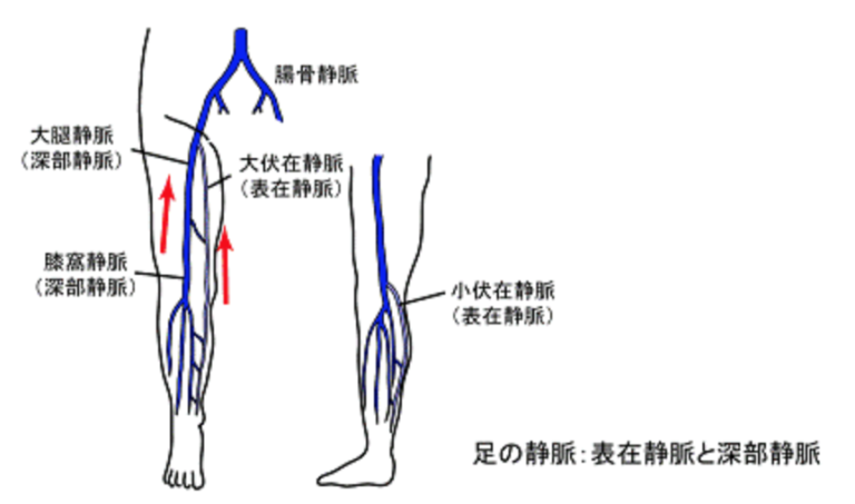 大伏在静脈血栓症のリスクが最も高いのは誰ですか?